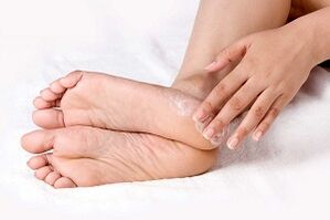 tratamento da crema de fungos na pel do pé